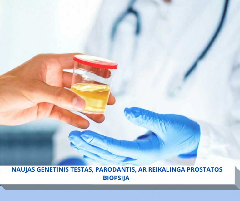 Naujas genetinis testas parodantis, ar reikalinga prostatos biopsija. UROLITA